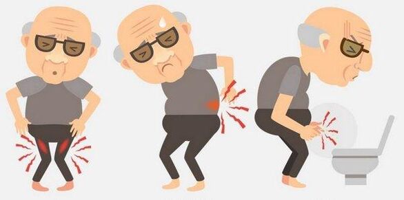 Prostatitis Symptome
