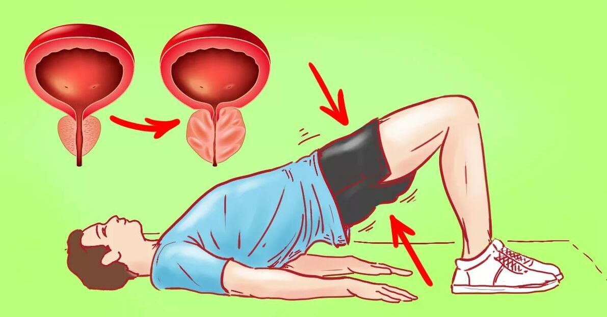 Übungen gegen Prostatitis.